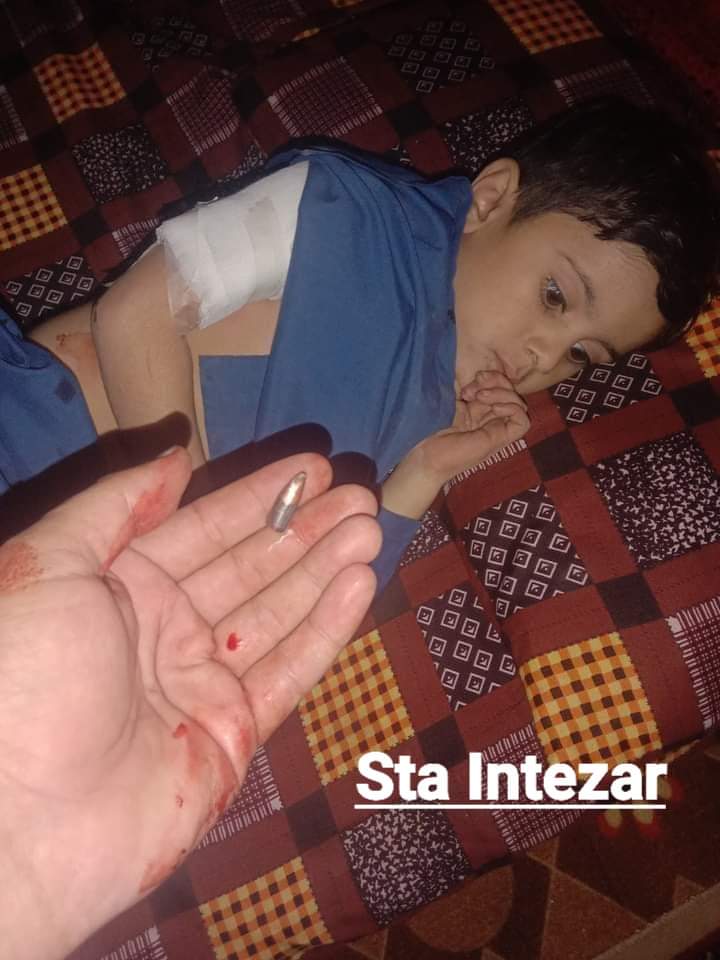 AlamZeb79531126's tweet photo. میچ جیتنے کی صورت میں ہوائ فائرنگ سے اجتناب کریں
#Dontfire #Please 
Alhamdulillah he is fine 😍
@MuhammadAiteza @MirhaAfridi @HeyGuday @Shoaib_Jatt @SanamBalochfans @anjumtariq6 https://t.co/E9qhJsrMxe