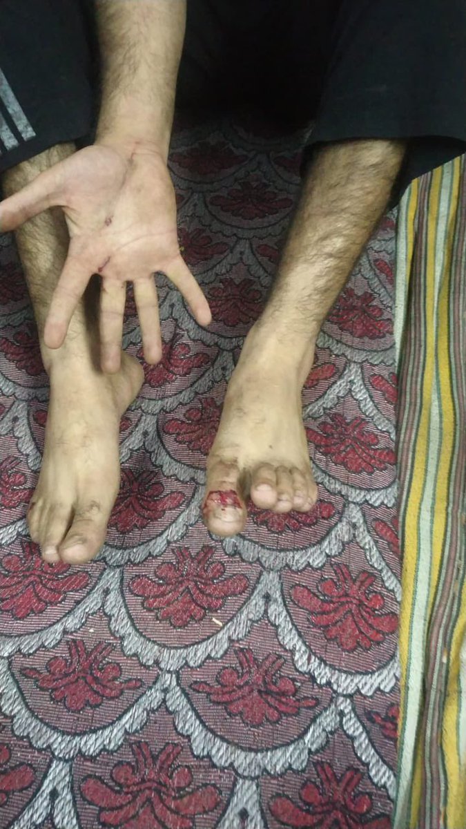 shahriyarsyed1's tweet photo. Distressing Pictures of injured Kashmiri Students thrased in a college in Punjab after Pakistan wins cricket Match against Indian.

#kashmir 
#IndiaVsPak 

Updates from :@NasirKhuehami https://t.co/6fkb9cCFFZ