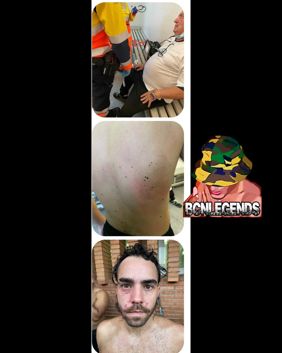 bcnlegends's tweet photo. Denuncian que un equipo de fútbol agredió físicamente al contrario al estar perdiendo. #bcnlegends #urbangraffitisbcn #blegends #tgnlegends https://t.co/tsyaAKPaVg