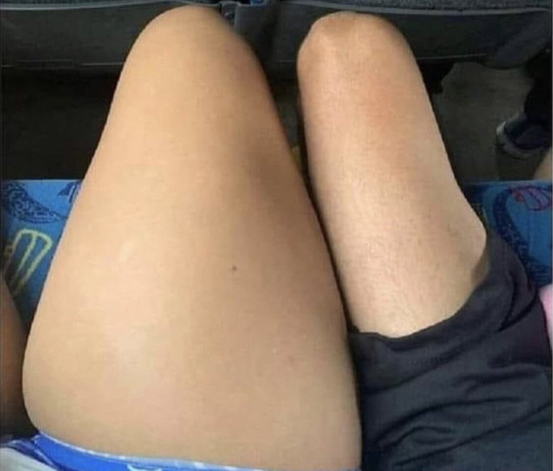 El comienzo de una relación tóxica