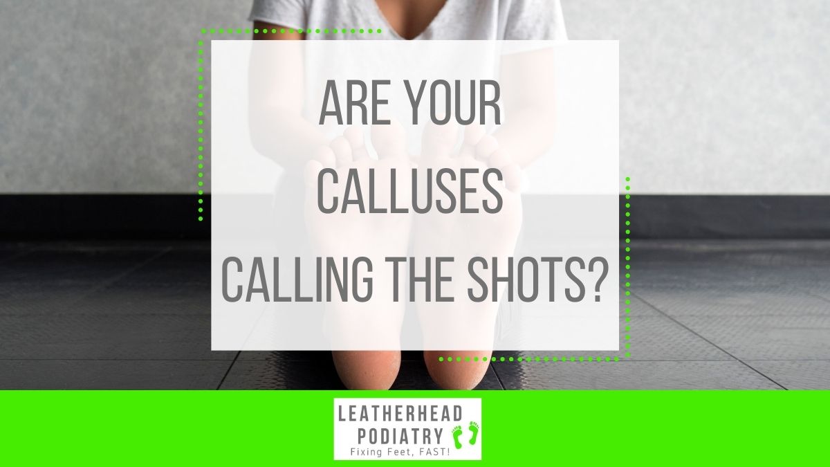 Yellowish or pale in colour &amp; lumpy to touch because the skin is thick. If you think you have calluses, give us a call on 01372 374125 to see how we can help!

#LeatherheadPodiatry #FixingFeetFast #Podiatrists #PodiatryClinic #Leatherhead #Surrey #Arthritis #Gout #FootPain