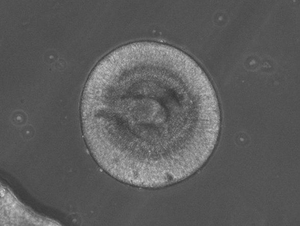 Vision_INM's tweet photo. Good morning! Happy to start our week taking care of our beautiful retinal organoids

#retinalorganoids #retinaldisorders #iPSCells #culture #science #research #retina https://t.co/tCeL03cKy2