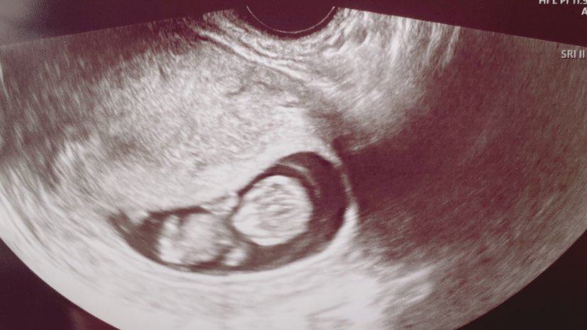 妊娠３ヶ月 Twitter Search Twitter