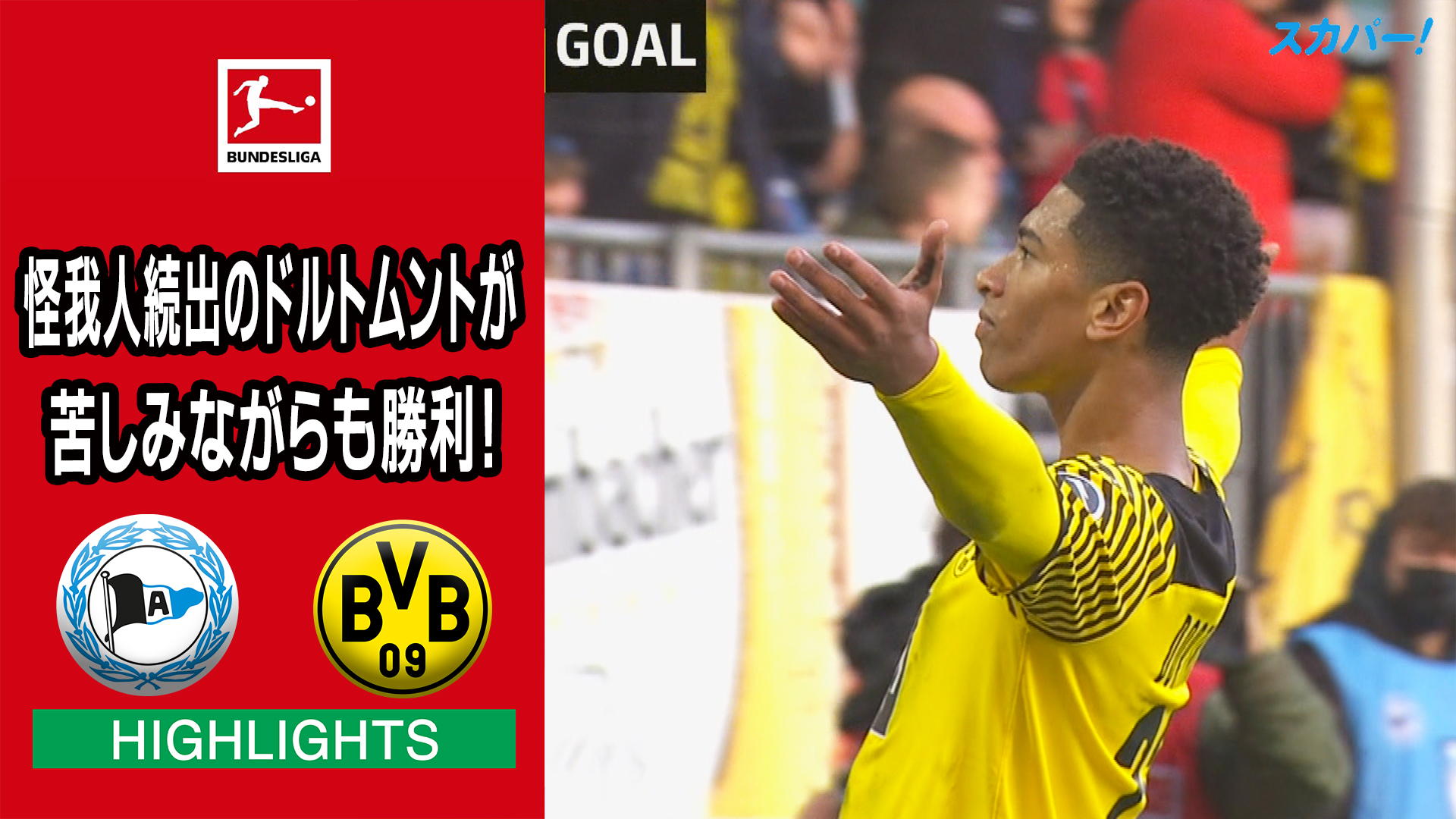 ブンデスリーガ スポーツライブ Powered By スカパー ハイライト 怪我人続出のドルトムントが 苦しみながらも勝利 ブンデスリーガ 第9節 ビーレフェルト ドルトムント 見逃し配信 T Co L4rpsb94xl 美しいサッカーは