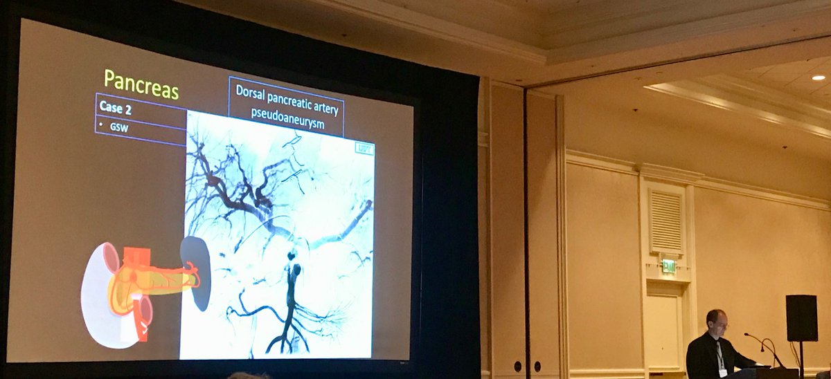 Alyssa_Varsanik's tweet image. Dr. Ahmed at the forefront with his vision of the “Hybrid OR.” Dr Lorenz explains the fix for pancreatic artery pseudo aneurysm. @UChicagoIR  @uchicagosurgery 
#HowToSaveALife Conference 2021