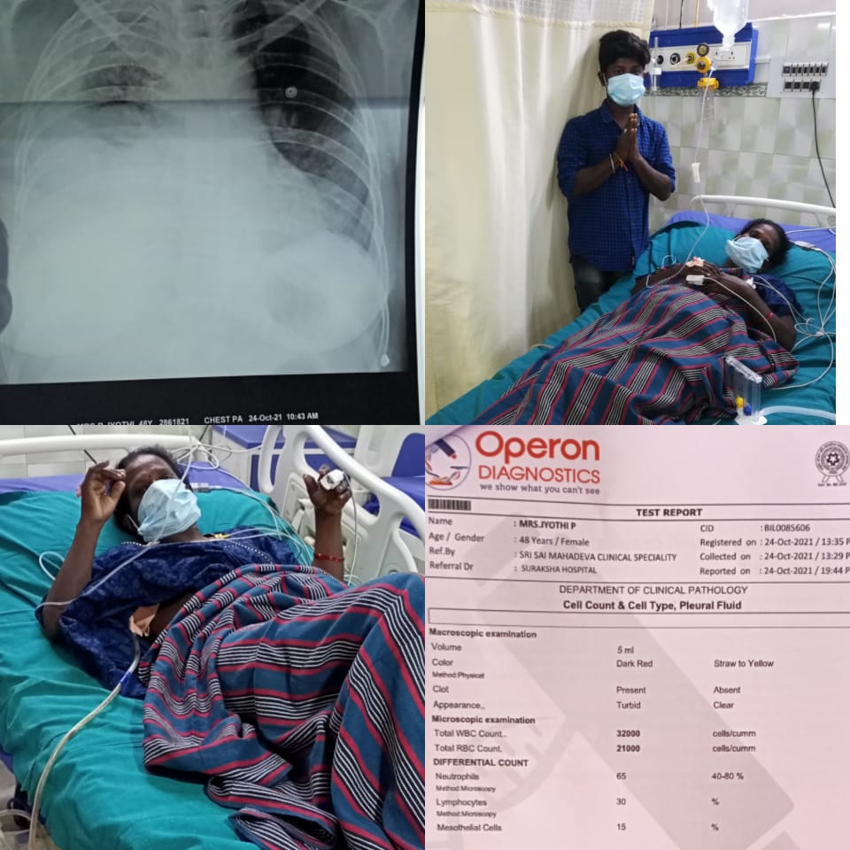 NKolishetty's tweet photo. @KTRTRS @SonuSood @Sonusoodfounda1 ఈ అమ్మ పేరు పంతం��ి జ్యోతి
కొన్ని నెలలుగా లివర్ ఊపిరితిత్తుల వ్యాధితో నరకయాతన అనుభవిస్తుంది
ఆ కొడుకులు తల్లిని కాపాడటం కోసం ఉన్న ఇల్లు ని కూడా తాకట్టు పెట్టి వైద్యం చేపిస్తున్నారు..
ఆ తల్లి ప్రాణాలతో బయట పడాలంటే 3లక్షల వరకు ఖర్చు అవుతుంది https://t.co/qvTXr0mD88