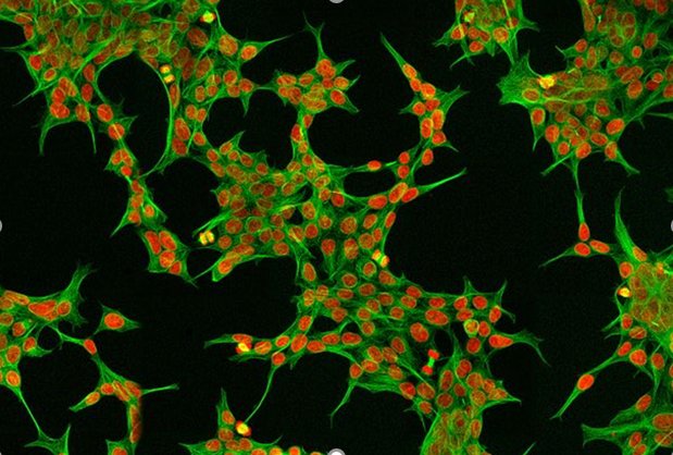 conceptionxtech's tweet photo. Concinnity Genetics was launched by Jessica Birt and Matthew Dale from @RosserLab @SynthSysEd @EdinburghUni to optimise and reduce side effects of gene therapies using AI.
Find out how at the #CXDemoDay2021 👇
https://t.co/KZg1DpPCOT
#cohort4reveal #deeptech #venturescience https://t.co/FvbklsmErD