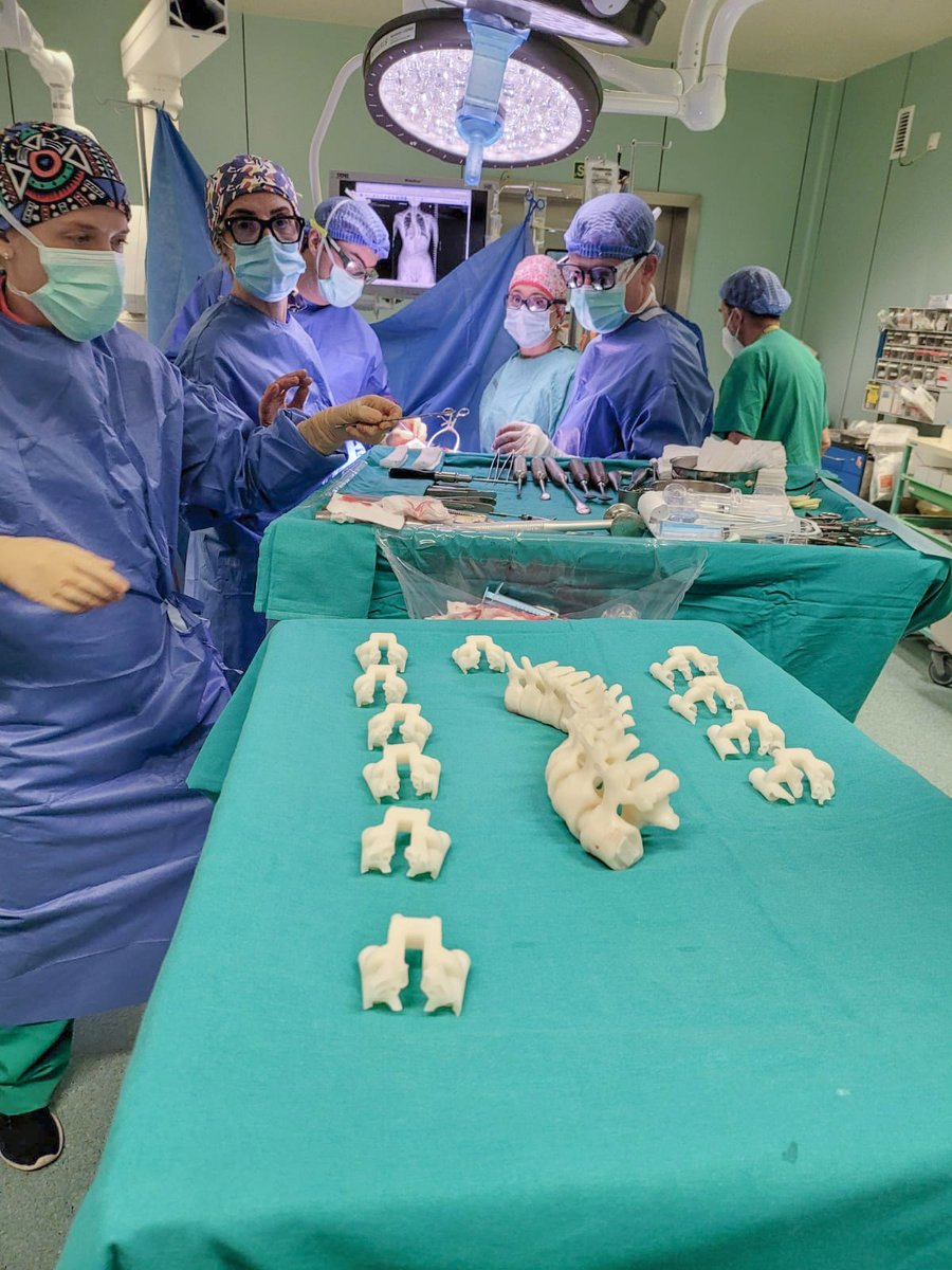 HospitalLaFe's tweet photo. 🏥📰El @HospitalLaFe realiza una intervención pionera en España con guías firefly para corregir una deformidad de columna.  Tras una reconstrucción en 3D de la deformidad se han impreso las guías y se han colocado los tornillos sin necesidad de rayos X.
🔗https://t.co/75q663cKgl https://t.co/qzTbsLonzu