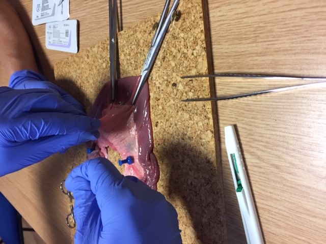 Well done to our brilliant Core Surgical Trainees and Foundation Doctors who demonstrated very near perfect suturing in our anastomosis workshop! A massive thank you to <a href="/timcs1968/">Tim CS</a>, Mr Alkhusheh and Mr Kenny for taking the time to deliver this valuable teaching. <a href="/sashnhs/">SASH NHS Trust</a> #OneTeam