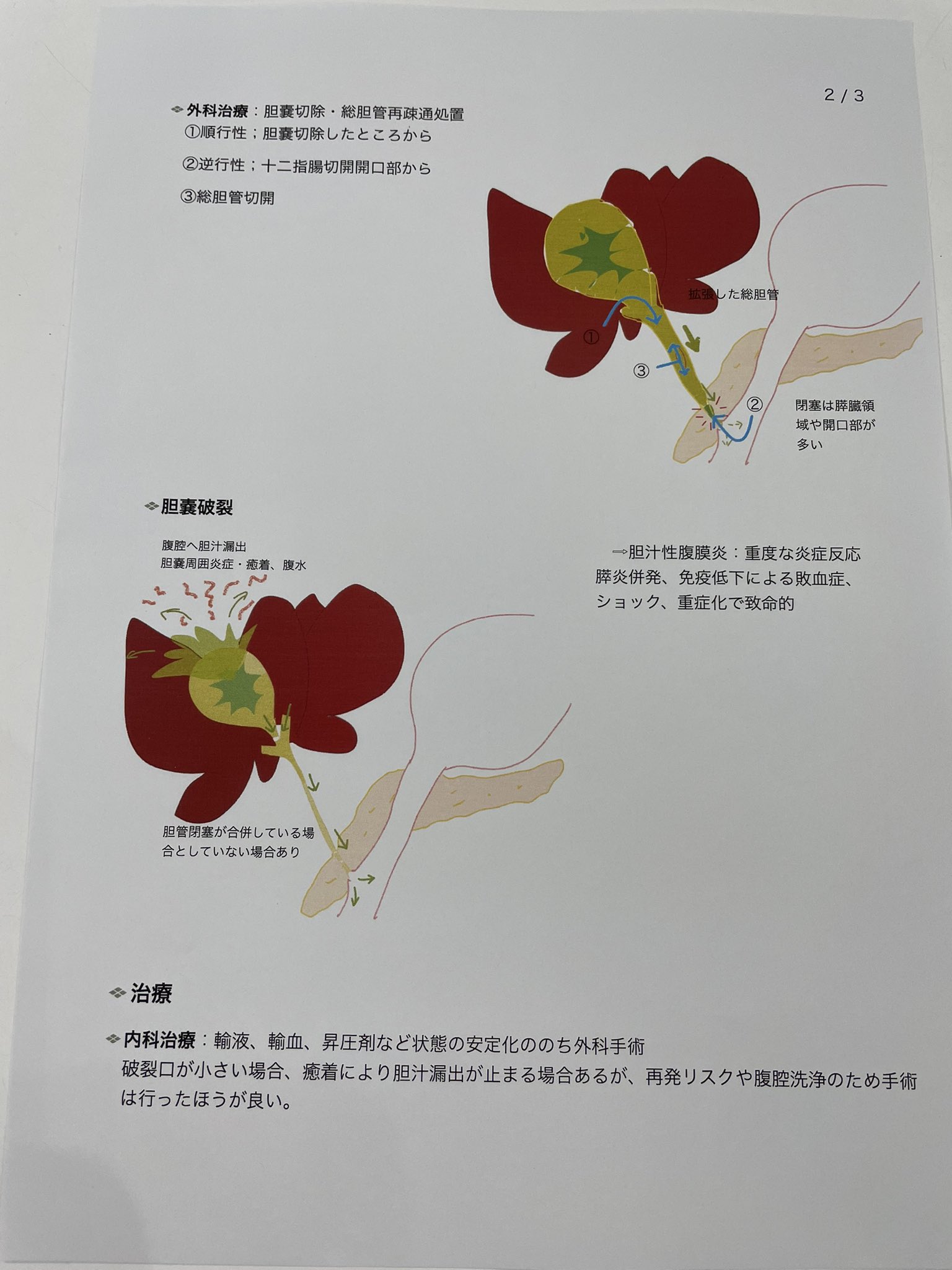 胆嚢粘液嚢腫 Twitter Search Twitter