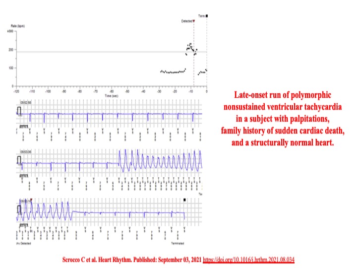 Raviele Antonio tweet media