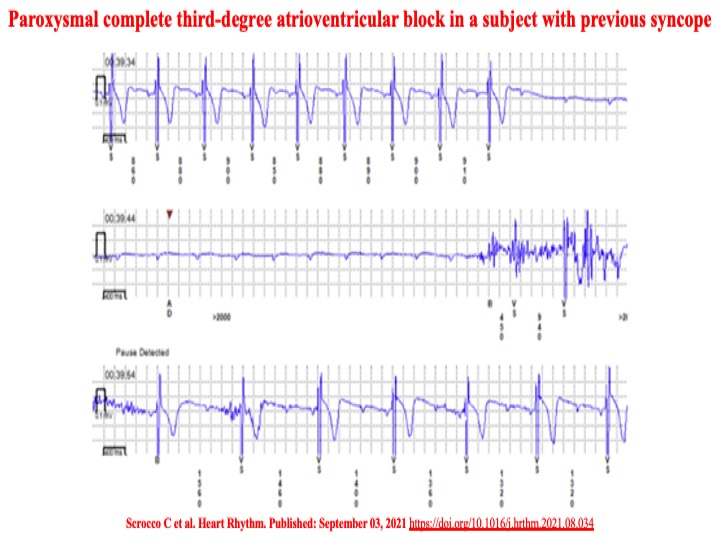 Raviele Antonio tweet media