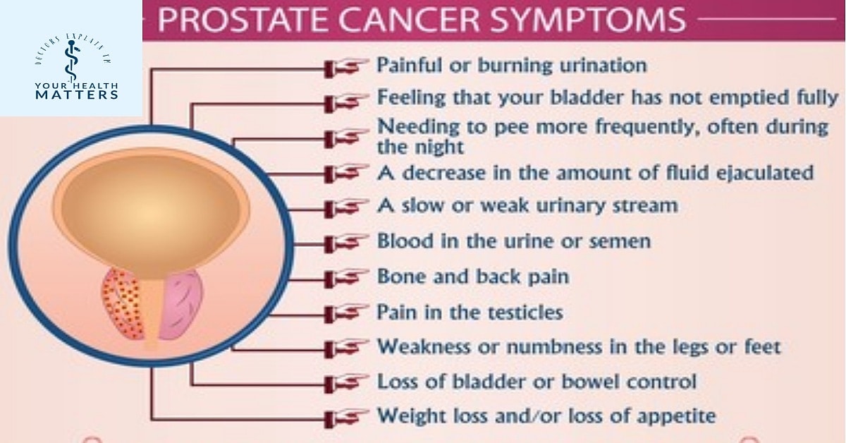 DocsExplainFM's tweet image. #prostatecancer #prostatecancerawareness #prostatecancersymptoms #prostatecancerriskfactors #prostatecancereducation