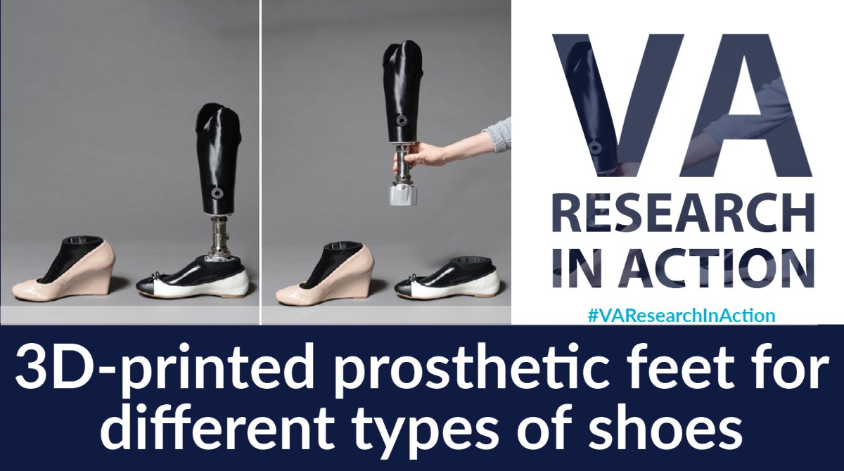 VAResearch's tweet photo. #VAResearchInAction: VA prosthetists developed a method to allow women Veterans with lower-limb amputations to wear whatever type of shoes they want, including heels, whenever they want to.
#VAresearch @VAMinneapolis
https://t.co/ONHSJzs5BJ https://t.co/apLW8rPWEv