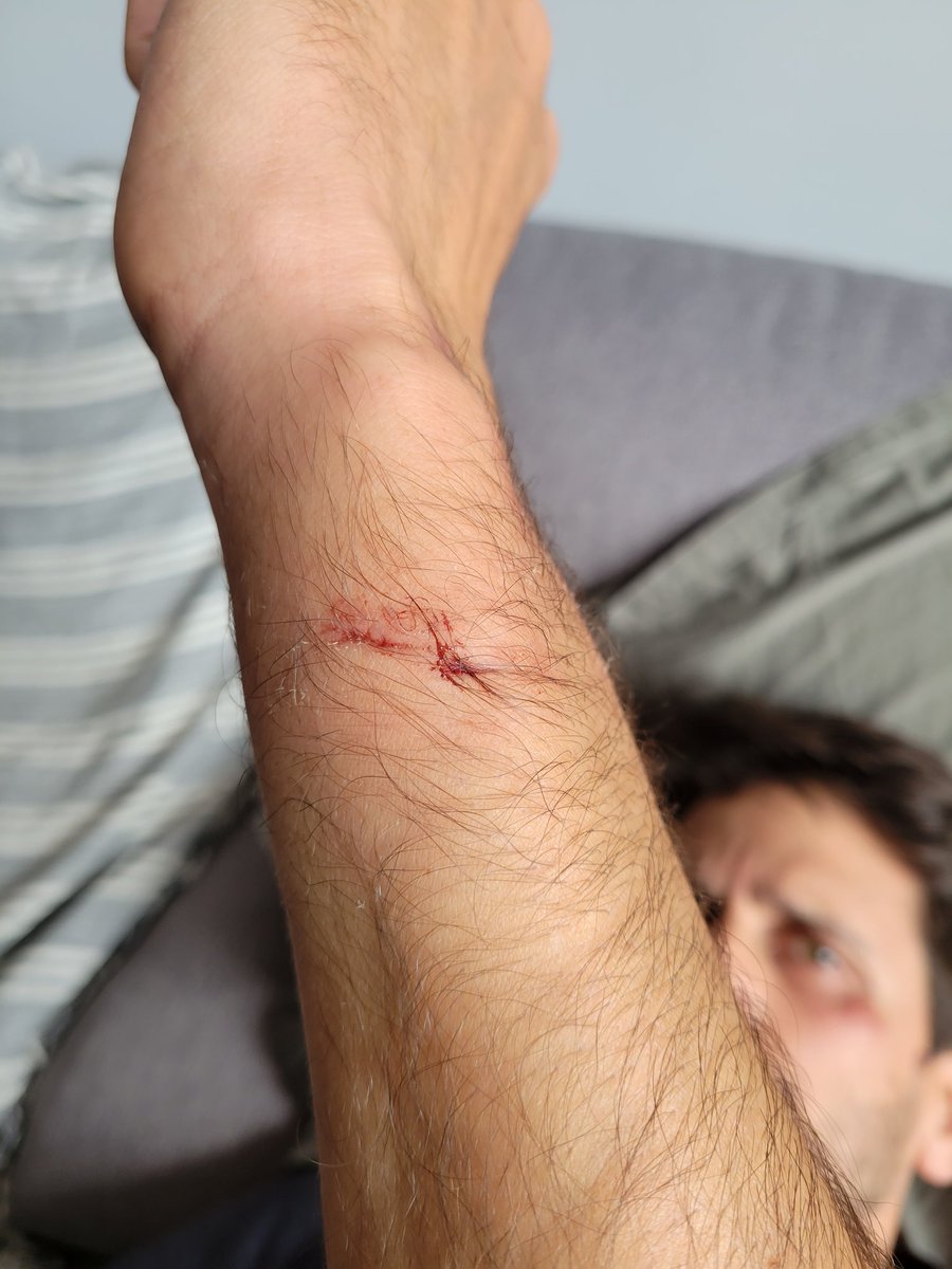 galiadvorak's tweet photo. El pasado jueves 21 de Octubre, 4 guardias de seguridad de @rodalies le pegaron una paliza a mi novio rompiéndole un diente, dejandole un ojo morado y varias magulladuras por todo el cuerpo. https://t.co/0gLPu11p7B