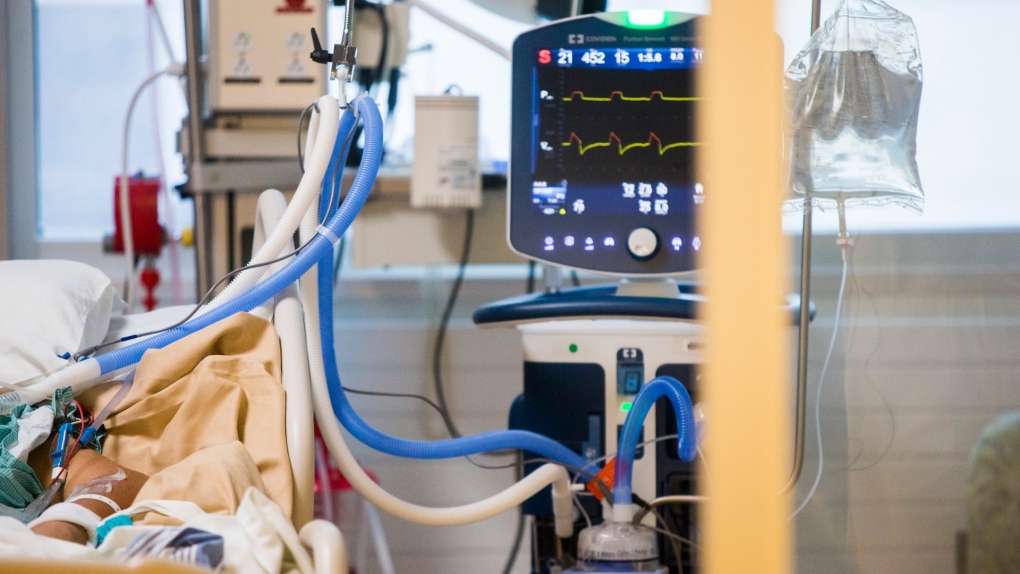 'Absolutely shocking': Saskatchewan considers next stage of triage amid COVID crisis regina.ctvnews.ca/absolutely-sho…