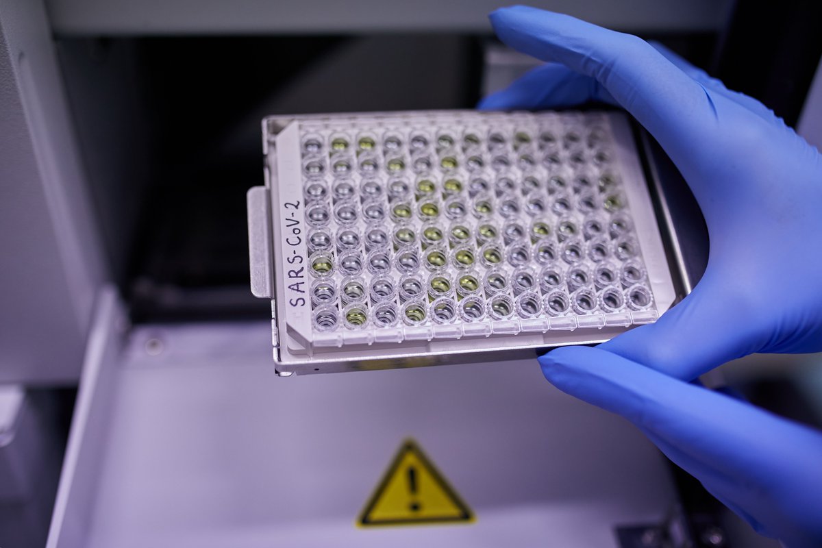 From #CharitéBerlin &amp; <a href="/DRFZ_Berlin/">DRFZ</a> in <a href="/Nature/">nature</a>: #SARSCoV2 disrupts immune response timing. In severe #COVID19, the body produces the immune-dampening messenger TGFβ at the beginning rather than the end of infection, thus blocking the innate immune system. charite.de/en/service/pre…