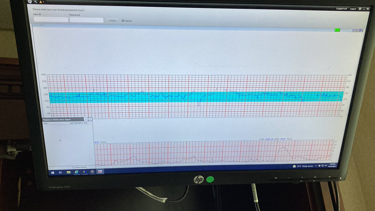 JKR_Duo's tweet photo. Pitocin upped. 8mU/min. K is doing good now. Just relaxing. Heart rates doing well too. https://t.co/8a5xVctnaC