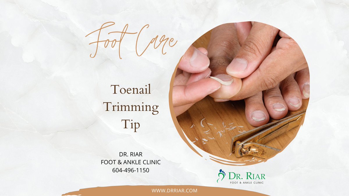 vancitydpm's tweet photo. Trim #toenails straight across but not too short careful not to cut #nails in corners or on sides can lead to #ingrown toenails Persons with #diabetes poor circulation or #heart problems should not treat their own #feet because they are more prone to #infection
#foot #podiatrist https://t.co/yIJLgufHLa
