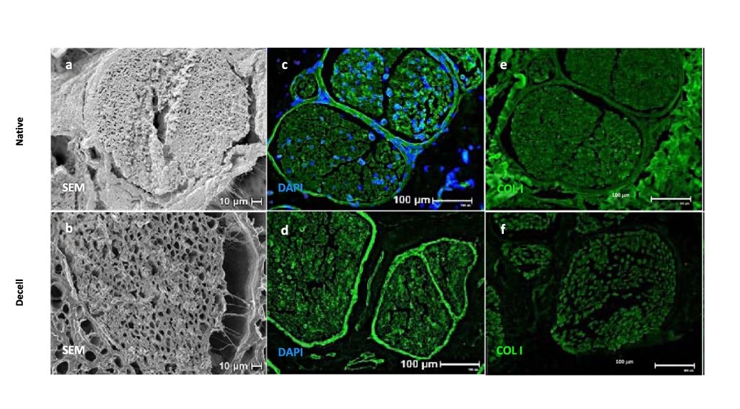 ExtracellMatrix's tweet image. Today in @Nature_NPJ!

📍 @McGowanRM scientists indicate that nerve-specific #ExtracellularMatrix hydrogel promotes functional #regeneration following nerve gap injury.

Read more: go.nature.com/3b7cK2Z