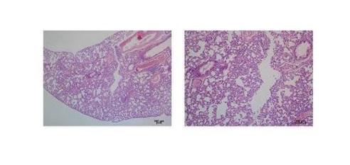 MammaryCell's tweet image. Dr. Liu and colleagues at the State Key Laboratory of Oncology in South China performed circular RNA #microarrays in order to elucidate expression profiles of HER-2-positive #breast #cancer cells. 🔎
More here:
📌 bit.ly/3bc31bs