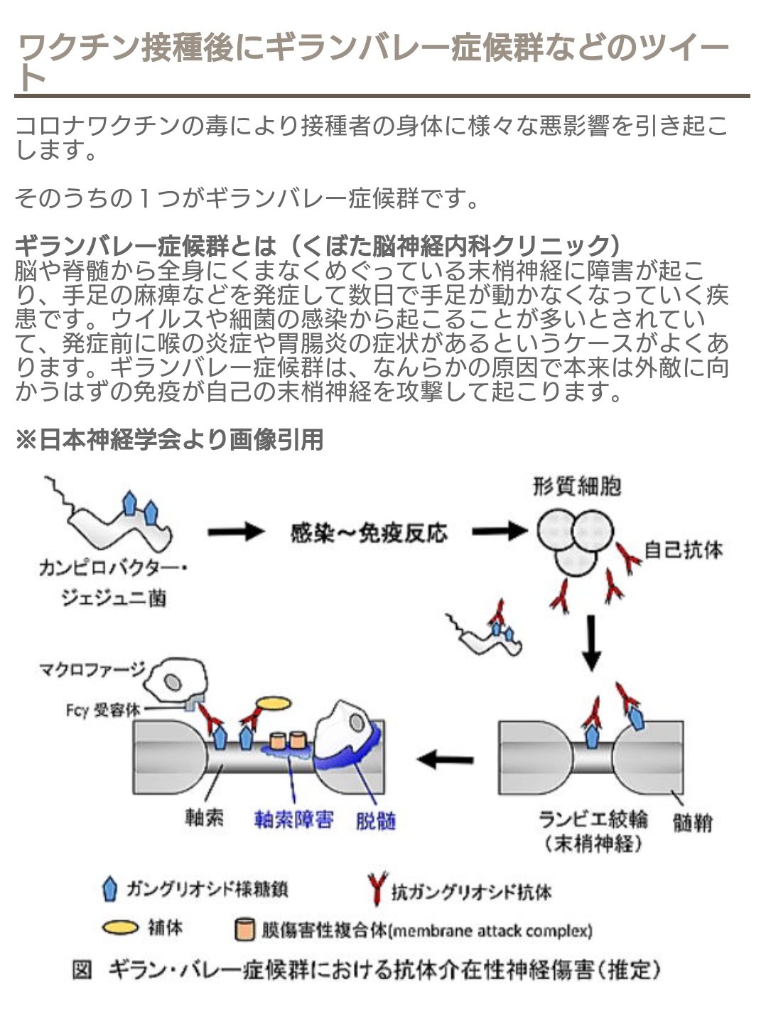 ワクチン接種
