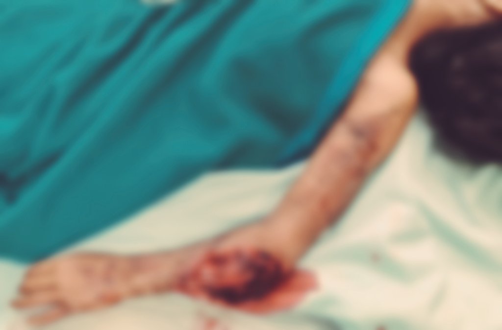 kemarin ad pasien anak2 yg kasiann bgt,cedera berat gara2 saat membonceng,kain yg dipakai tersangkut di ruji motor,anakny jatuh&amp;tangannya tersangkut di roda.patah tulang parah,robek otot,saraf.
masih 8thn&amp;tdk ad BPJS :(

Semoga byk temen2  yg bisa membantu
Ini cerita lengkapny :