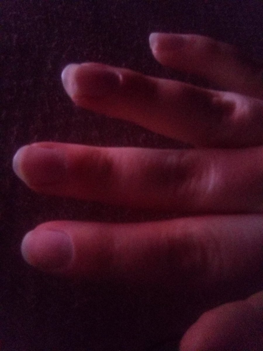 Broke a couple of my claws ouch.