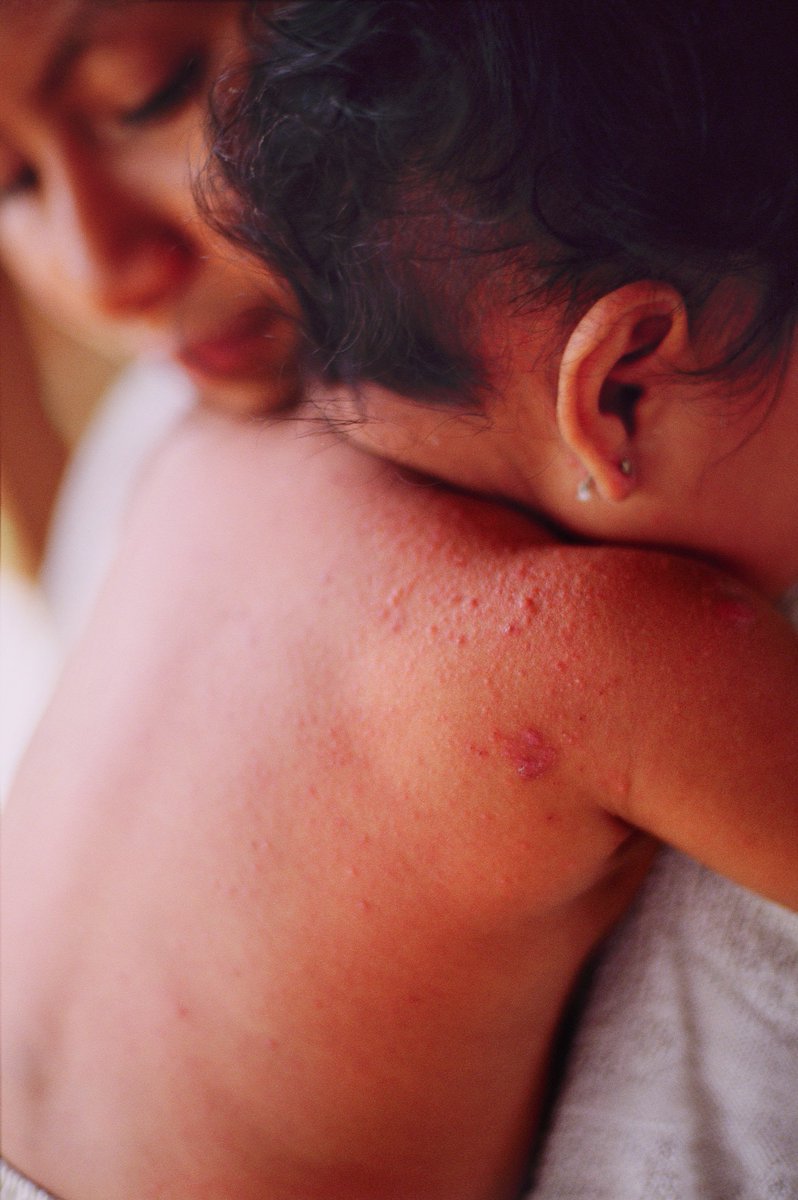 As we face a critical court argument today on my 812th day of house arrest, never forget what this case is really about.

<a href="/Chevron/">Chevron</a> caused a mass industrial poisoning in the Amazon that decimated Indigenous peoples. Six courts and 28 appellate judges found the company guilty.