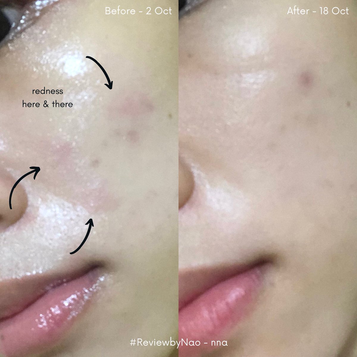 siapa yg suka punya masalah dgn redness? 👀 aku mau #RacuninSkincare cica seriesnya <a href="/chava_skin/">Chava Skin</a> yg calming &amp; soothing tp ramah di kantong nih!

• bantu ngeredain kemerahan
• fragrance free! aman u/ kulit sensitif
• super affordable! under 90k

yuk cek reviewnya di thread ini👇🏻