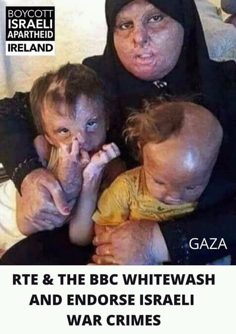 Abl_dry_'s tweet photo. @LadyVelvet_HFQ a palestinian family form GAZA,victim  of a white phosphorus chemical attack by israel funded by the US TAEPAYER. https://t.co/7ZAyRkGn2b