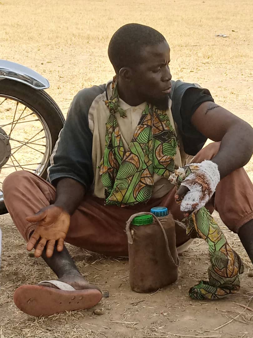 APPIC6's tweet photo. Cet ex-associé qui s'est rendu hier 26/10/2021 à Kolofata déclare avoir été blessé par bal par un combattant de BOKO HARAM alors qu'il cherchait à faire sortir son père de la brousse, comme pour dire que sortir de BOKO HARAM demeure toujours une entreprise périlleux
@HoinathyR https://t.co/LH1WNw1Oba