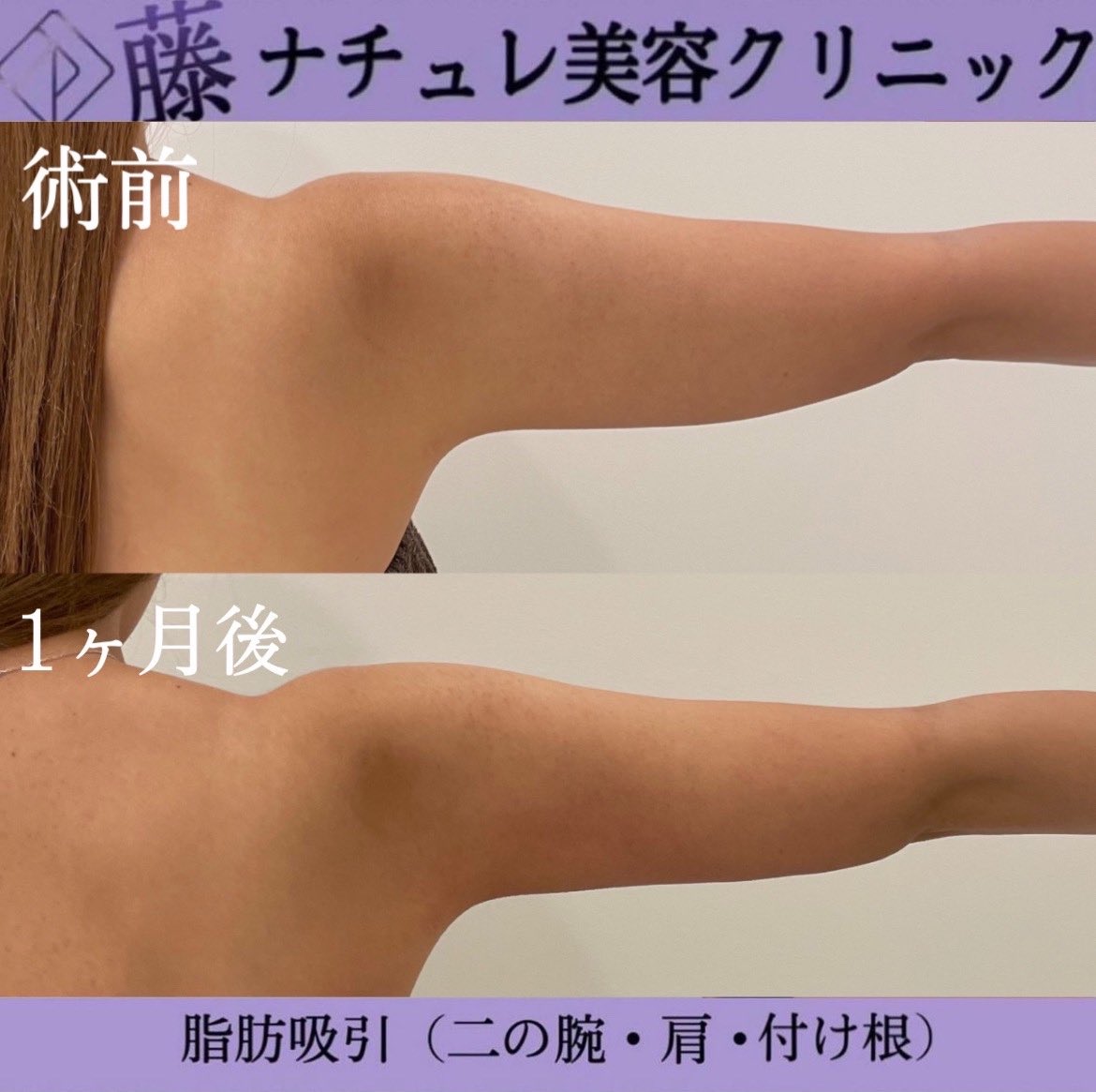 E8 84 E8 E8 B1 8a E8 B8 Twitter Search