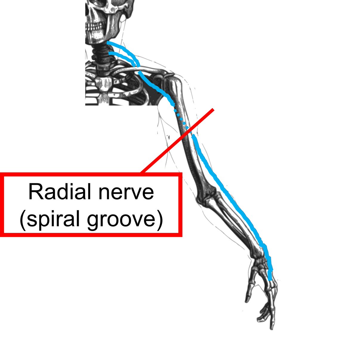 Spiral Groove - an overview