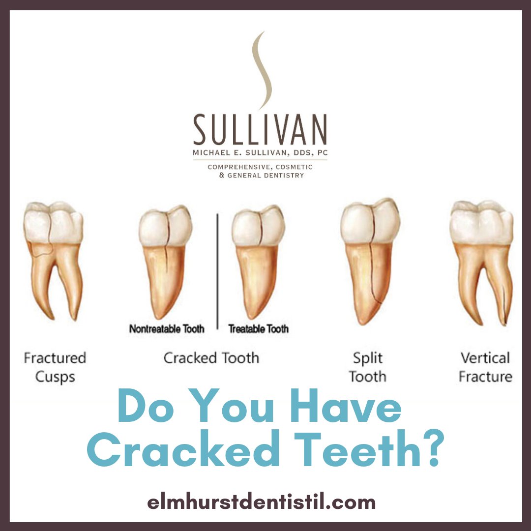 elmhurstdental_'s tweet image. Do you have #crackedteeth? It’s our job to identify the type of fracture correctly because the type of break determines the type of treatment required. 

Visit: elmhurstdentistil.com
#ElmhurstDentist  #MichaelSullivanDDS #MiniDentalImplants
#DentalCare #ToothPain
