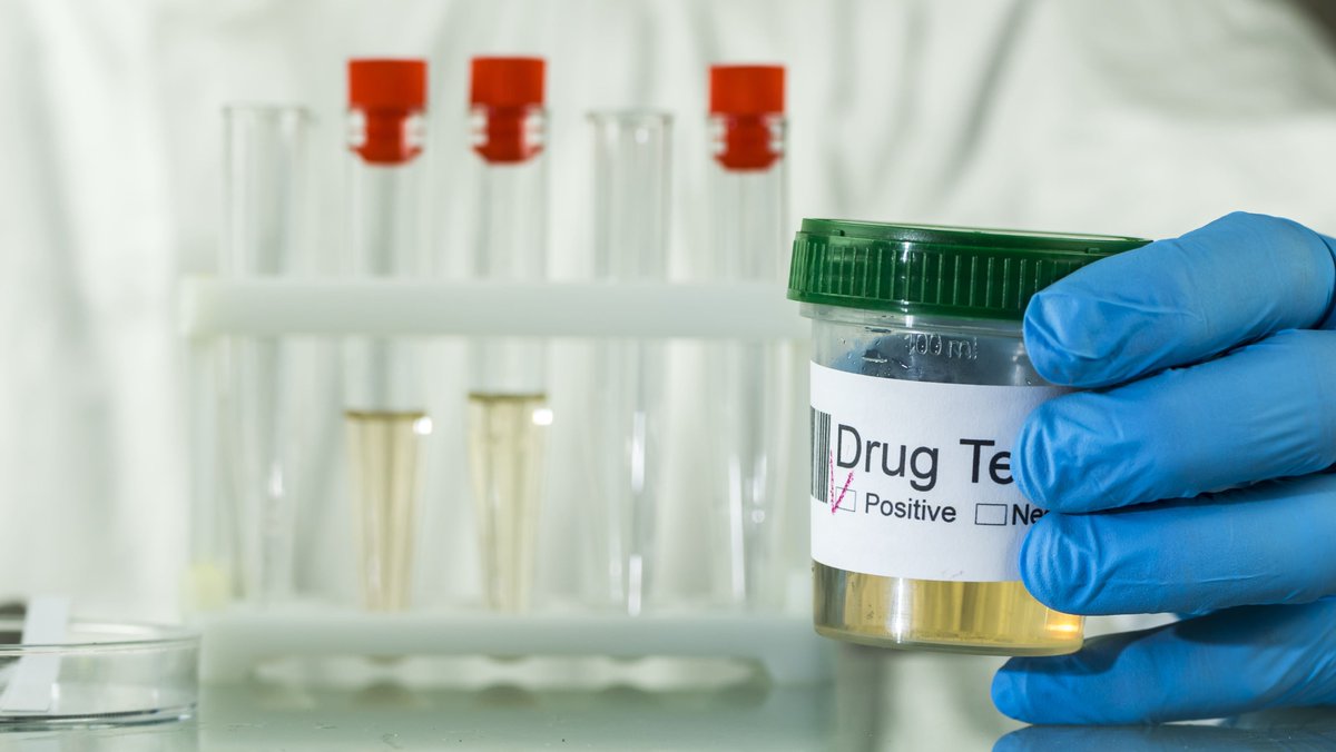 AmericasPharmaC's tweet photo. Certain over-the-counter medications and prescriptions could trigger a false positive drug test. It is important to consider these medications before taking a drug test.

https://t.co/osCpMzG0vb https://t.co/h9KS8xjoyd