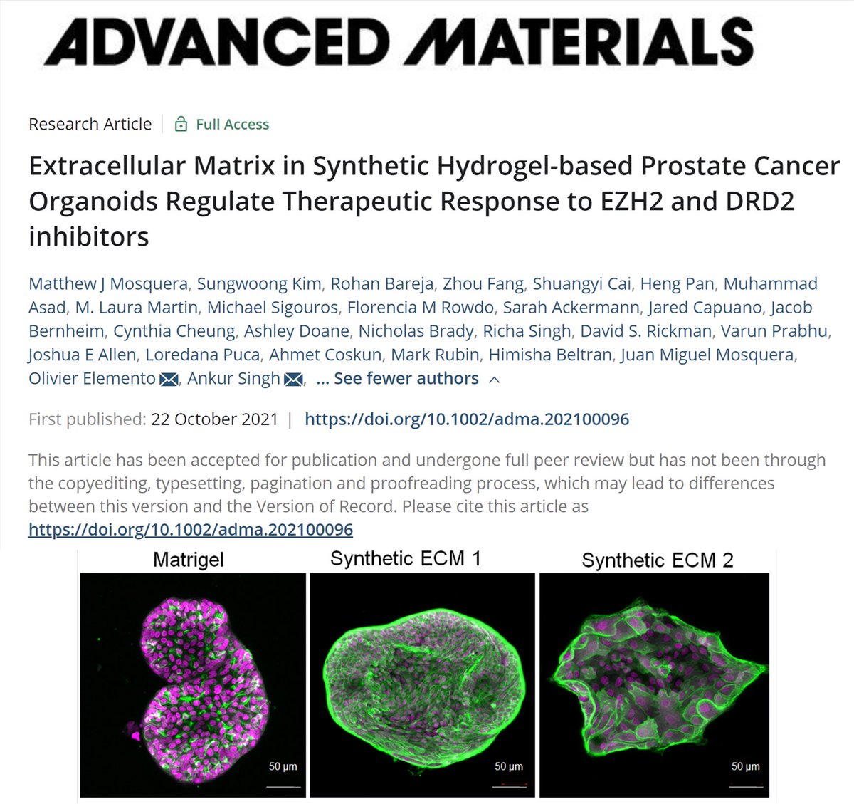 Dr_ASingh's tweet photo. Advanced Materials: We report synthetic hydrogel-based #prostate cancer #organoids that enabled discovery of Dopamine Receptor D2 inhibitors as potential new therapy for epigenetically reprogrammed neuroendocrine prostate #cancer. Congrats @MosqueraPhD👏🏽! https://t.co/T7hMazTiou https://t.co/kKMD2Ogn7W