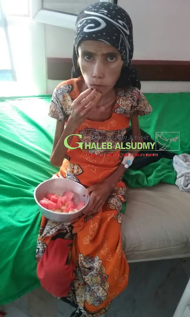 ghalebalsudmy's tweet photo. Yemen children are living the worst humanitarian disaster in history due to unjust war & siege!!
Without a serious move of UN to stop Saudi war, famine & the resulting diseases will take the lives of an entire generation of millions of children.
#4help 👇
https://t.co/Fvg0AyhqIH https://t.co/bAU95EQIi4