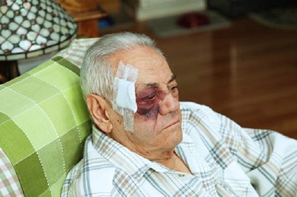VillariLaw's tweet photo. According to a medical study conducted by surgeons and doctors in Philadelphia, facial injuries are common in car accidents and are often severe.

Here's what you should know.
https://t.co/WySB4bKm6V https://t.co/9mPlFlLOZD