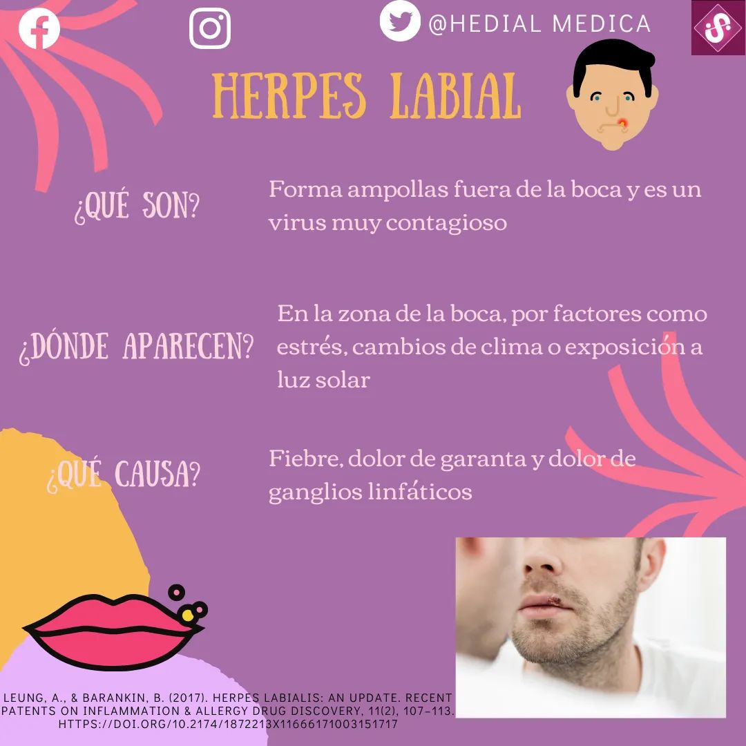 HedialMedica's tweet photo. Comienza con una picazón (prurito) en los labios, seguido de la aparición de ampollas que ser convierten en heridas y costras posteriormente. Desaparecen alrededor del décimo día.
#herpeslabial #salud #medpost #medicina #hedialmedica https://t.co/bGQmHHMM55