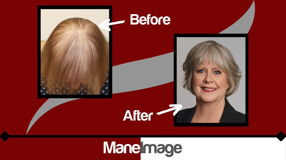 ManeImage's tweet photo. The CNC hair 😍 can make a huge difference!
The best part is, we use 3D printing technologies to make it specifically for your scalp. You may even forget that you are wearing it. 😉
🟥
◼️
🟥
#CRLab #CNCHair #CRLabUSA #CRLabTrichology #CesareRagazzi #3DPrinting #3DPrinter https://t.co/7TVBybPFbD