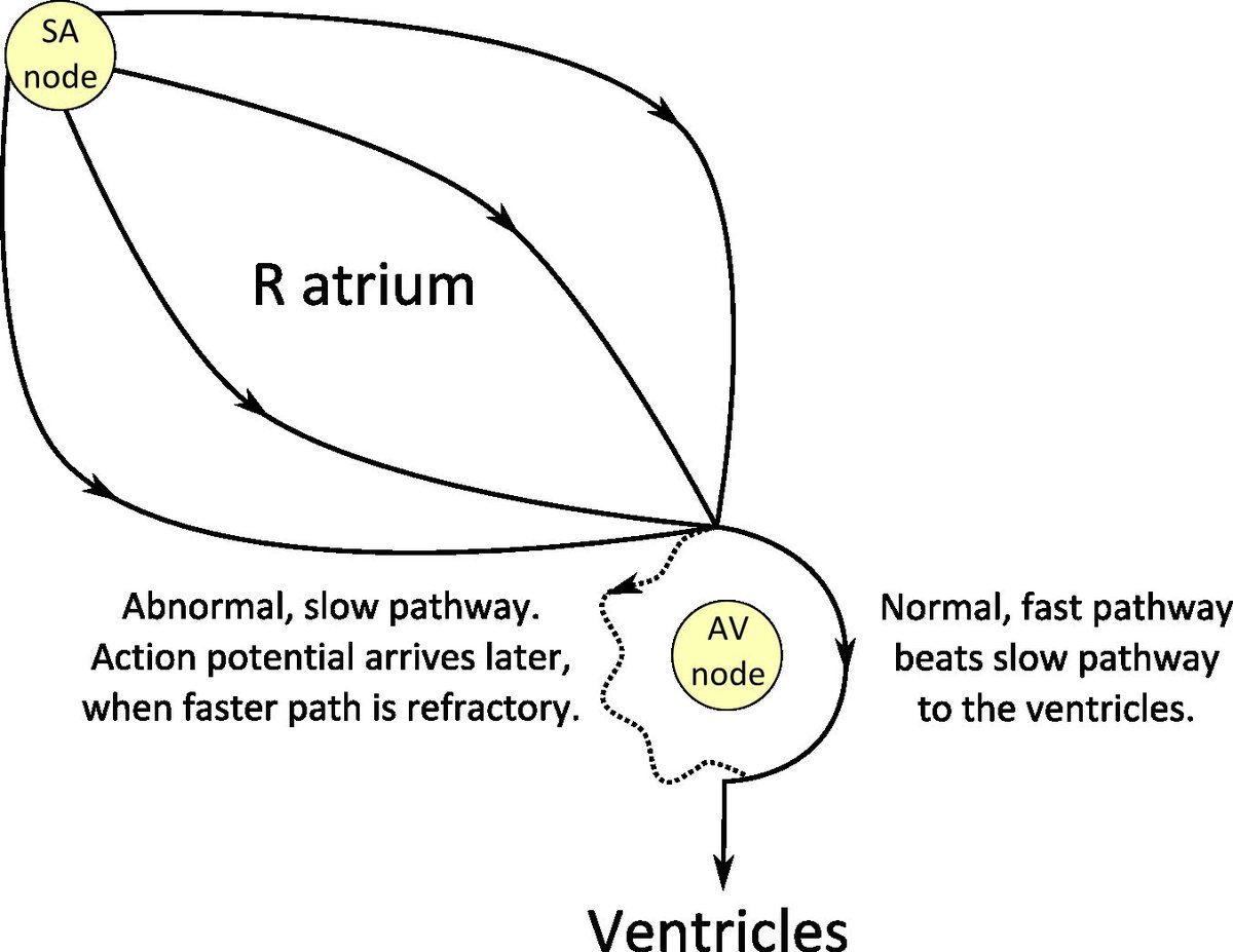 Stimulus takes two routes simultaneously — the fast pathway and the slow pathway.

To experience a fath pathway emotional response, try buying your wife an anniversary present from Walgreen’s.