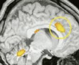 ecalixto's tweet photo. El enamoramiento es una ADICCIÓN = se quiere más y más de la persona. 
Se presenta ansiedad al no saber del amado. 
No hay calma hasta que habla con la pareja. 

#NeuroTuit https://t.co/SzO4Vbs20e