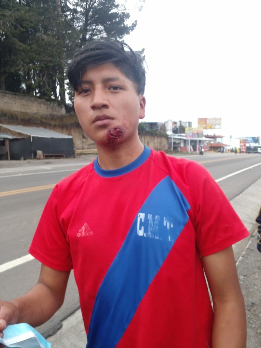FreddyHM84's tweet photo. @LassoGuillermo En las fotos se nota claramente como la policía respetó los DDHH mintiendo como siempre pandorasso. https://t.co/WvSJXYi3x2