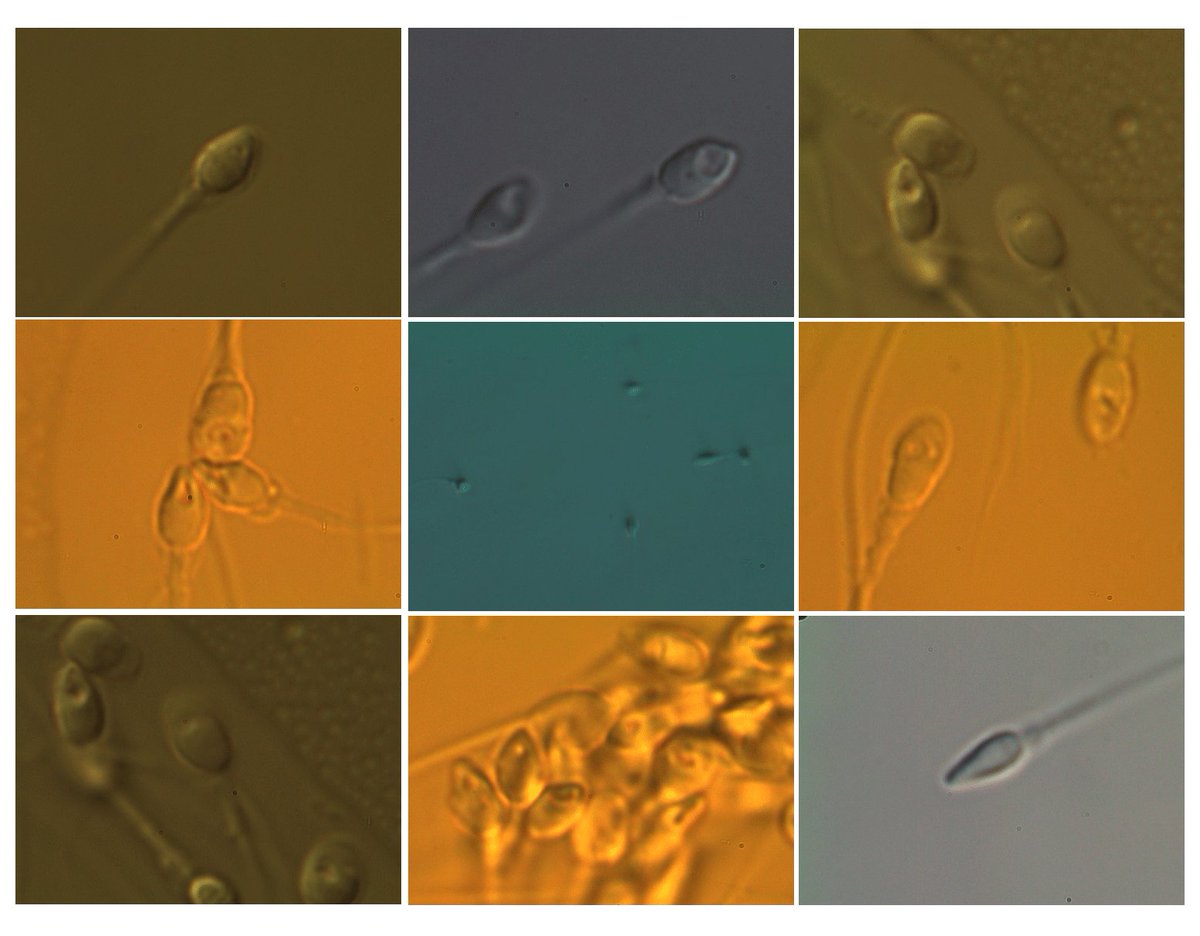 “Men &amp; Miscarriage”  Sheena Lewis talks <a href="/RBMO/">Renata</a>  “Sperm DNA Frag., is a Novel Biomarker for Early Pregnancy Loss"

‘Gen. Testing of Products of Conception in Recurrent Pregnancy Loss ’ E. Dahdouh

“Publications of Importance”  N. Garrido &amp; <a href="/DennySakkas1/">Denny Sakkas</a>  
ivfmeeting.com