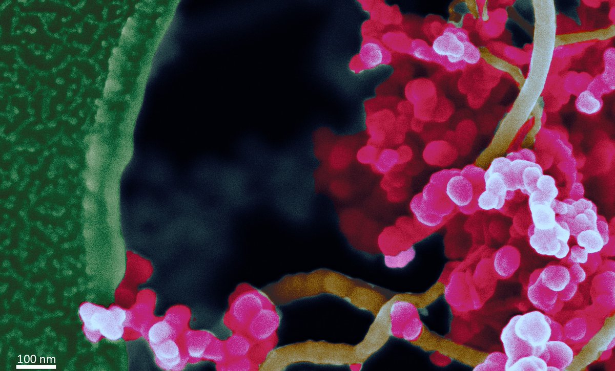 Here comes our first #WhatIsItWednesday special! Can you imagine what this false-color image shows? Don't be shy an type your guess. 💡