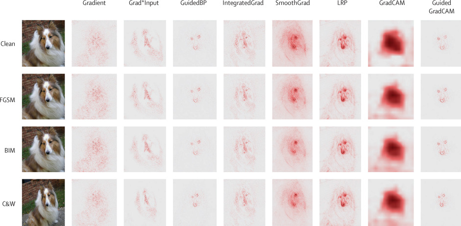 NEW Viewpoint by Marzyeh Ghassemi (<a href="/MarzyehGhassemi/">Marzyeh</a>), Luke Oakden-Rayner (@DrLukeOR) and Andrew L Beam (<a href="/AndrewLBeam/">Andrew Beam</a>): 'The false hope of current approaches to explainable #ArtificialIntelligence in health care'. <a href="/MIT/">Massachusetts Institute of Technology (MIT)</a> <a href="/VectorInst/">Vector Institute</a> <a href="/TheAIML/">Australian Institute for Machine Learning</a> <a href="/HarvardEpi/">Harvard Epidemiology</a>
bit.ly/3vO21Uw