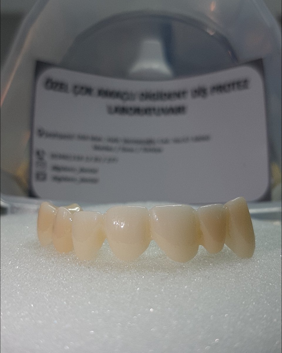 digident_dental's tweet image. Monolotik Zirkon Çalışması.
#redon 
#exocad
#dwos
#monolotikzirkonyum