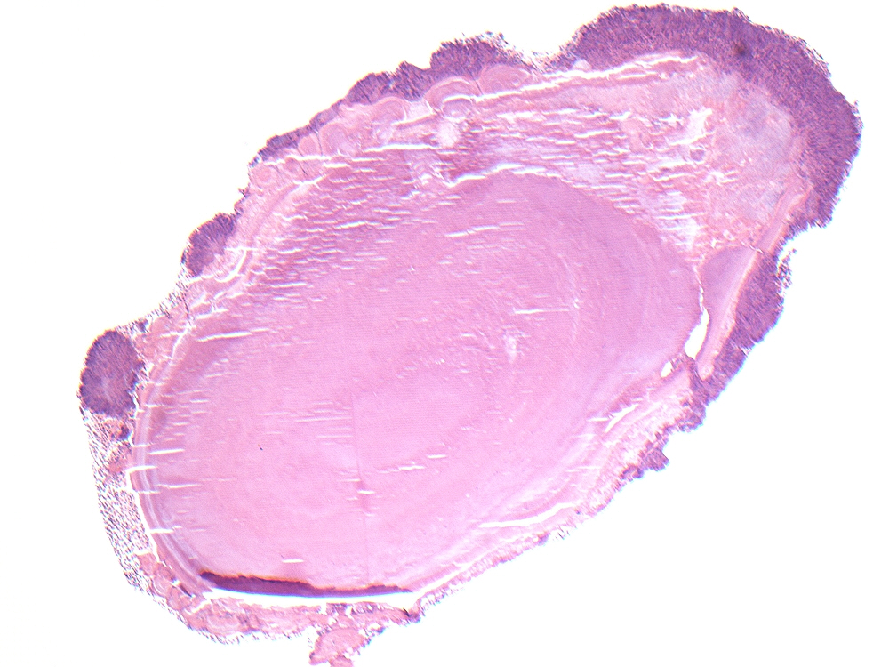 Oral Path Opinion tweet media