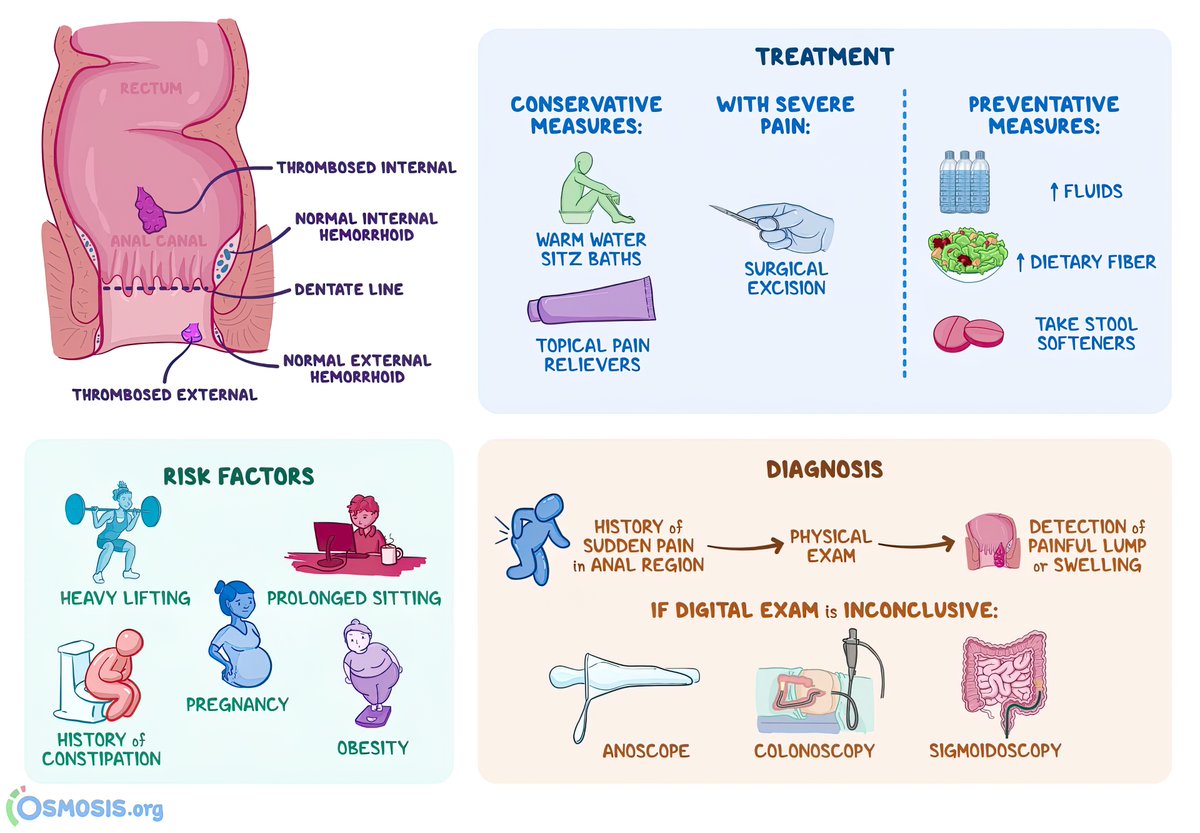 Haemorrhoids #4KMedEd #GITwitter

(Courtesy of <a href="/OsmosisMed/">Osmosis from Elsevier</a>)